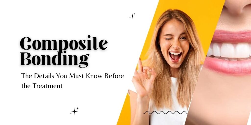 Composite Bonding_ The Details You Must Know Before the Treatment